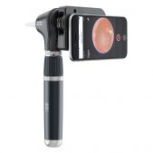 3,5 V LED MacroView Plus Otoskop für iExaminer (mit kostenloser App)